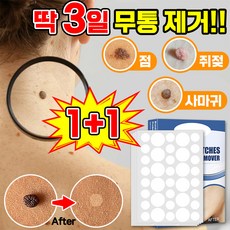 [빠른배송] 피부 제거 패치 얼굴 바디 피부 치료 라벨 스텔스 포장증정, 1개, 143매입