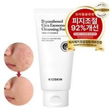 피지 92%개선 여드름완화 클렌징폼 모공세정 시카엑소좀 진정보습 약알칼리 저자극 블랙헤드 피지제거 논코메도제닉, 1개, 120ml 1개, 120ml