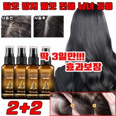 [미국 개발] 1+1/2+2 바이오틴 탈모 방지 및 발모 미스트 헤어 탈모 미스트 탈모 트리트먼트 손상 모발 개선 탈모 완화, 4개, 30ml