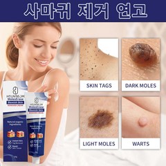 티눈제거 연고 편평사마귀연고, 2개, 20g