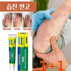 (본토출하)Herbal 1+1 피부 가려움증 한포진 습진 피부건조 알레르기 발포 습진 등의 증상 완화 연고, 2개, 20g