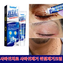 SUMIFUN 편평사마귀 물사마귀 얼굴 물사마귀 쥐젖 치료하다 크림, 20g, 4개