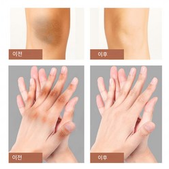 (1+1)바디화이트닝 밀키화이트 톤업 겨드랑이 팔꿈치 엉덩이 목 색소 침착 미백크림, 50g*2