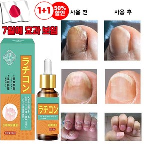 손발톱 리페어 발톱연화 영양제, 1개, 30ml