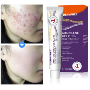 DERMFREE 트러블케어 리페어 크림 스팟 케어 문제피부 자국 모공 진정 피지케어 크림, 1개, 20g