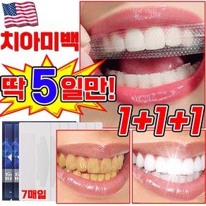 [국내배송] 미국 1/1+1/2+2 치아 미백 패치 셀프 치아미백 제 화이트닝 얼룩 제거 스티커