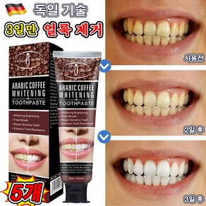 [효과보장] 독일 미백치약 치아미백제 화이트닝 커피/담배 치아 강력 미백, 5개, 100ml