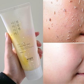 앙쥬 나의시카 필링젤 [Anjo my cica peeling gel] 당일발송, 1개, 180ml