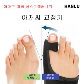 [한정특가] 무지외반증 교정 세트 발가락 케어 교정기 - 전문 발 관리로 무지외반증 개선, 2개