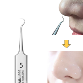InLoop 피지제거기 초정밀 블랙헤드 핀셋 전문가용 모공 압출, U자형
