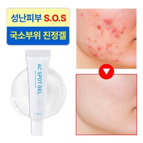 이엔코스 응급피부 긴급진정 AC스팟겔 15ml