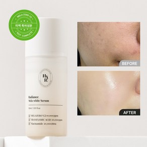 헤아림 래디언스 멜라 화이트 세럼 30ml 미백 물광 에센스 기미 잡티, 1개, 30g