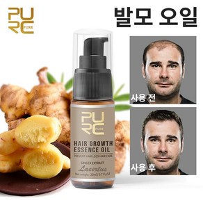 PURC 탈모 보습 성장 촉진에센스 탈모 모발 활력 증진 모낭, 2개, 20ml