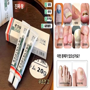 {약국강력 추천} 발톱무좀크림 발톱무좀 발톱 빠진다 발톱 변색발톱 두꺼워짐 발톱 갈라짐, 2개, 20g