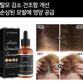 [당일 배송] 원형 탈모증 KS인증 치료제 M자형 예방모낭 성장 개선 LY006, 2개, 29ml