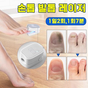 [미국 기술] 손톱 발톱 레이저 문제성 네일 치료기 곰팡이 제거 풋케어