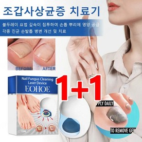 1+1 독일 손톱 관리 미니 기기 조갑사상균증 치료기, 65g*2, 2개