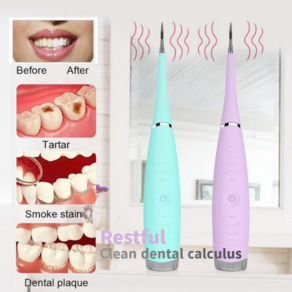 RESTFUL Electic Dental Calculus Remove, 민트, 1개