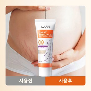 [국내당일발송] 오트밀 아미노산 스트레치 수분 공급 튼살 복원 크림 임산부 산전후 탄력 케어, 1개, 40g