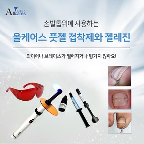 올케어스풋젤 하드 소프트 내성발톱 파고드는 발톱교정 젤레진 고정 Allcares footgel