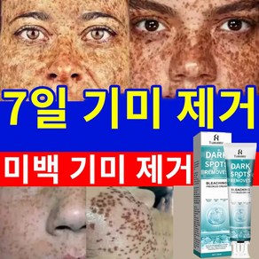 기미크림 멜라토닝크림 멜라논크림 얼굴의 기미 제거 검버섯 주근깨 피부개선 얼굴 미백, 2개, 20ml