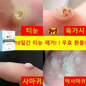 [국내배송] 티눈 밴드 티눈제거 밴드 보호테이프 발바닥 통증 풋케어