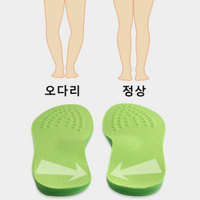 기능성 오다리 소프트깔창 오다리깔창 오다리 자세 교정용 깔창 특수 설계 기능성 오다리완화 소프트깔창, 1개