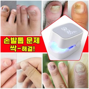 [당일 발출] 발톱 레이저 치료기 손톱 문제성발톱 관리기 네일레이저