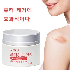 흉터 완화 여드름 흉터 수술 자국 전용 피부 재생 크림 색소 침착 개선, 2개, 50g