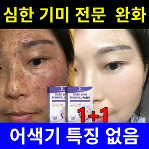 기미패치 기미 크림 멜라토닝크림 멜라논크림 얼굴 기미 멜라닌 색소 완화 촉촉하고 환한 피부 완성, 4개, 144개입