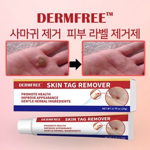 [미국 수입]Demfee 사마귀연고 99.99%제거하다 편평사마귀 사상사마귀 얼굴 사마귀 모든 종류의 사마귀에 효과적 W021, 1개, 20g