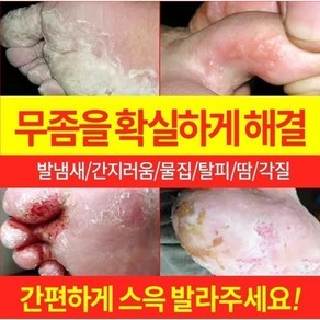 {국내 배송/일본 도쿄 R&D} 발 냄새를 빠르게 제거 / 무좀소독 / 가려움증 방지 및 살균 / 발 필링 / 발흘림 / 발흘림 / 물집 / 기타 발 관리, 1개, 20g