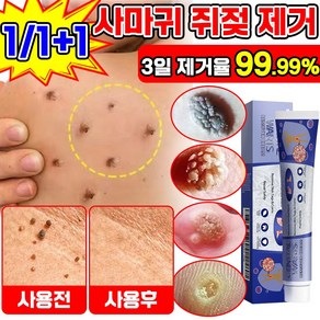 [빠른배송] 사마귀 연고 비립종 눈밑 지방 제거 크림 피부 여드름 치료 연고, 2개, 20g