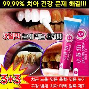 [99.99% 치아 문제 해결!!!] 3+3/2+2/1+1 베이킹 소다 효소 화이트닝 치약 치아 미백제 입냄새 제거 및 잇몸 케어 포장증정, 110g, 2개