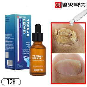 일양약품 문제성 손발톱 전문 리페어 세럼 영양제 토네일, 1개, 30ml