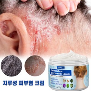 (국내배송) KORE LAN 지루성두피 비듬 각질 가려움, 1개, 50ml