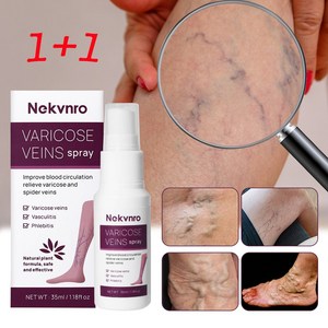 Nekvnro 하지정맥 스프레이 정맥 정맥류 케어 다리마사지 붓기빼는약, 2개, 35ml