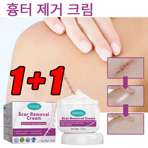 1+1제거 흉터 제거 크림 흉터제거연고 흉터 관리 제거 수술 흉터 제거 크림, 50g, 50g