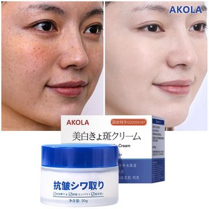 AKOLA 30g 기미제거크림 검버섯제거크림 색소침착 개선 미백 크림 수분 크림, 1개