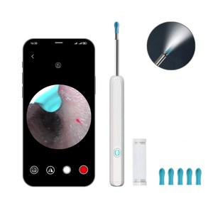 MountainWter 스마트폰 LED 내시경 귀이개 귀후비개 500W고화질카메라귀이개 LED 조명 소프트헤드 Type-C충전, 1개입, 흰색, 1개