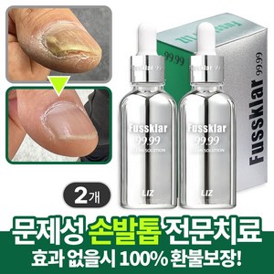 UC9 유씨나인 문제성 손톱 발톱 솔루션 리페어 세럼, 2개, 30ml