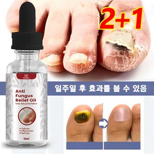 발톱 무좀 케어 손톱진균 발톱무좀 큐티클 트리트먼트 에센스, 10ml, 6개, 1개입