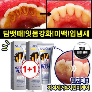 [미국 기술 3일효과!!!] 1/1+1 미백 치약 고불소 화이트닝 치약 입냄새 제거 및 잇몸 케어, 2개, 100g