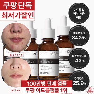 3일 여드름 재생진정 흉터 개선 앰플 [100만병 판매기념 한정 할인] [여드름 흉터 & 좁쌀 피지 개선 임상완료] 레티놀 어성초 히알루론산 나이아신아마이드 뮤아마 앰플, 4개, 30ml