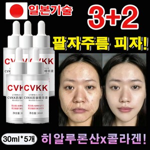 일본 저분자 콜라겐 히알루론산 앰플 주름개선 에센스 기미 미백 탄력 목주름 팔자주름 눈밑주름 케어 보습 광채 리프팅 안티에이징 앰플, 5개, 30ml