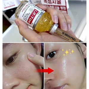 실리프팅 필러앰플 30ml/콜라겐실 리프팅실 톡스앰플/콜라겐 고톡스 안티에이징, 30ml, 1개, 5%-1개 단품