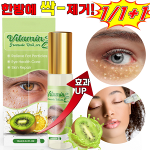 [효과 보장] 눈가 비립종제거 눈 밑 지방 제거 크림 한관종 다크서클 눈밑꺼짐 잔주름 개선 아이크림, 1개, 10ml