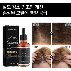 [당일 배송] 원형 탈모증 KS인증 치료제 M자형 예방모낭 성장 개선 LY006, 1개, 29ml