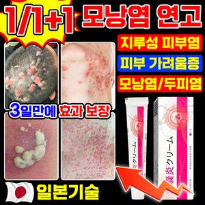 [당일출고] 일본 모낭염 연고 피부가려움증 지루성피부염 연고 여드름 크림 포장증정, 1개, 20.1g