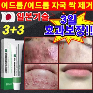 일본 1/1+1 여드름 제거 연고 색소침착 흉터 치료 리페 어 여드름 스팟 방지 문제 피부 케어 미백 재생 크림, 6개, 20g